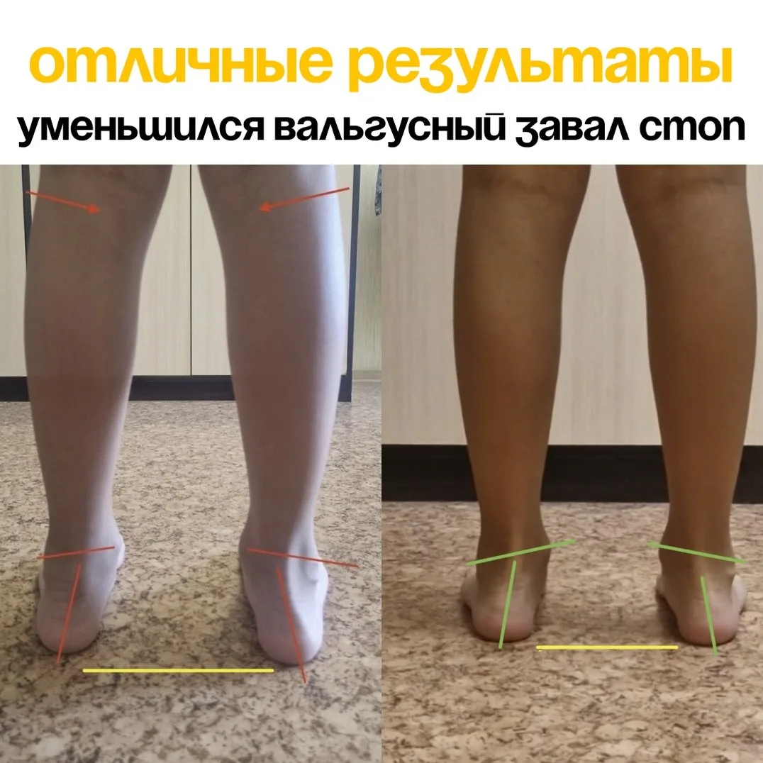 ✨ Посмотрите,  каких результатов можно добиться даже за 1 месяц занятий.  На фото Егор, ему 8 лет.  