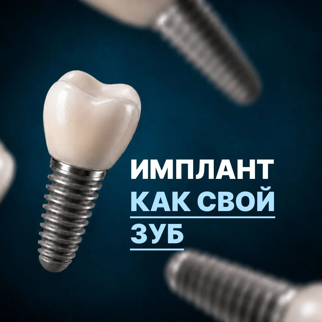 Имплант зуба с установкой от 23 900₽. 11 клиник в Казани