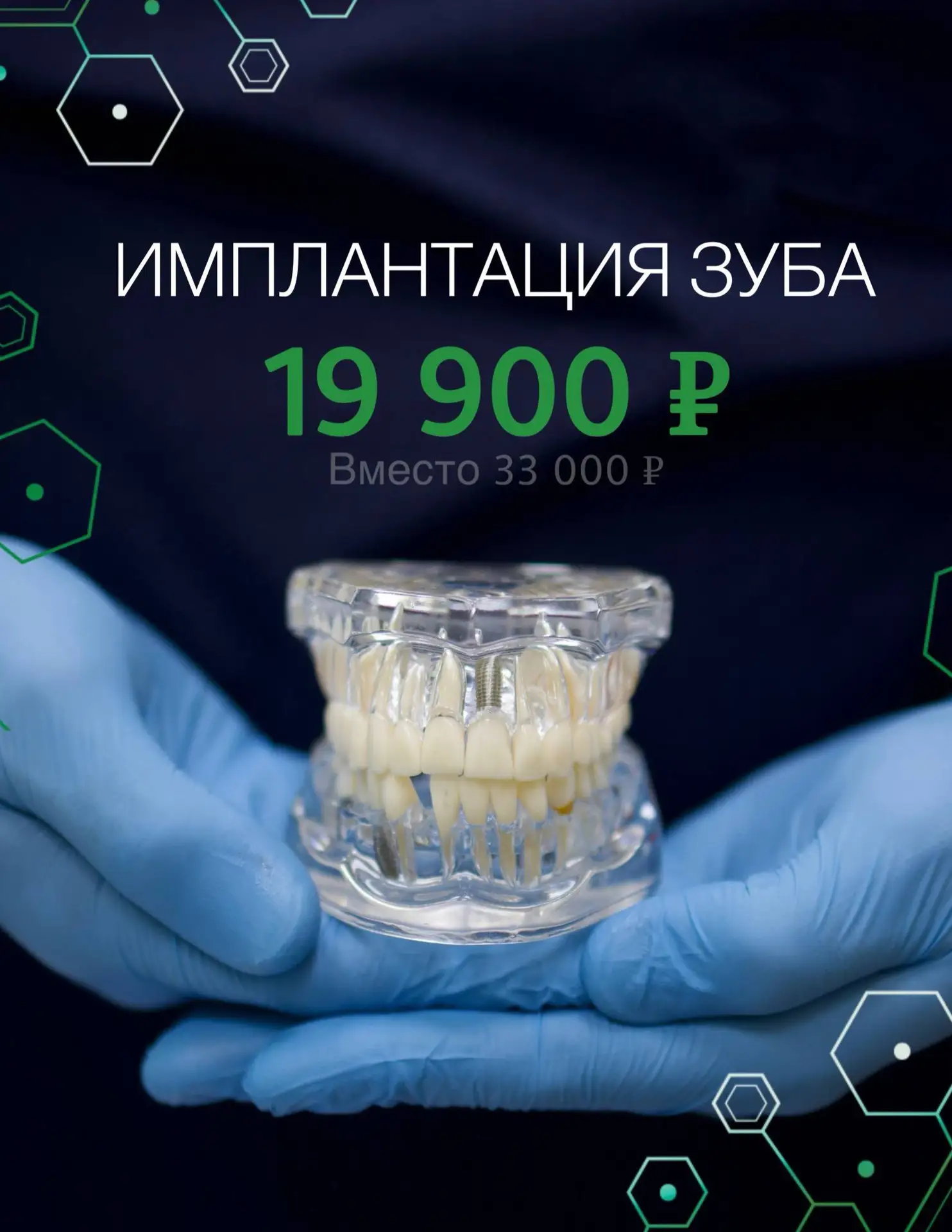 ИМПЛАНТАЦИЯ ЗУБА
19 900 ₽ вместо 33 000 ₽

Акция на имплантацию стала нашим абсолютным хитом за посл
