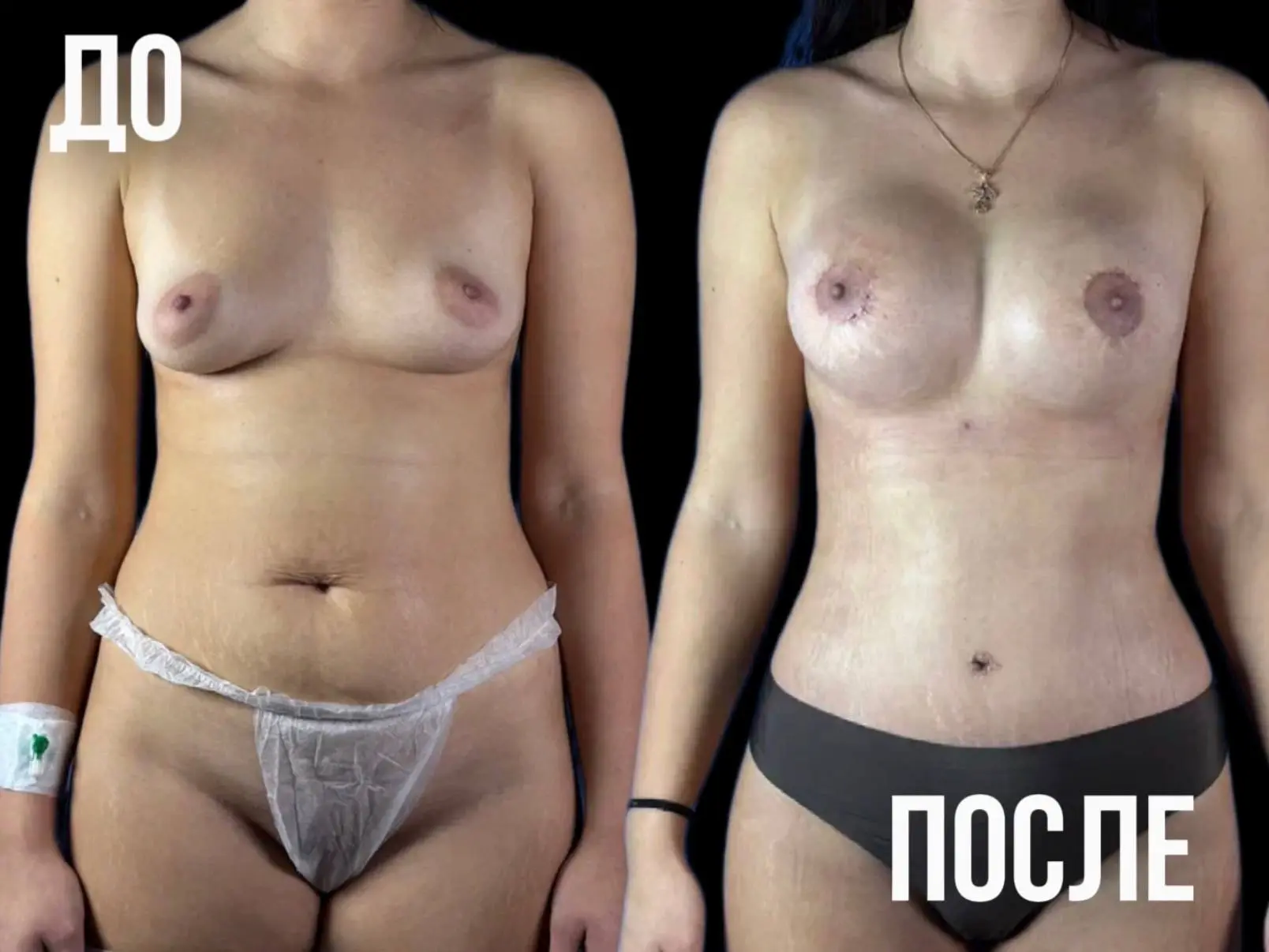Все изменилось после беременности.