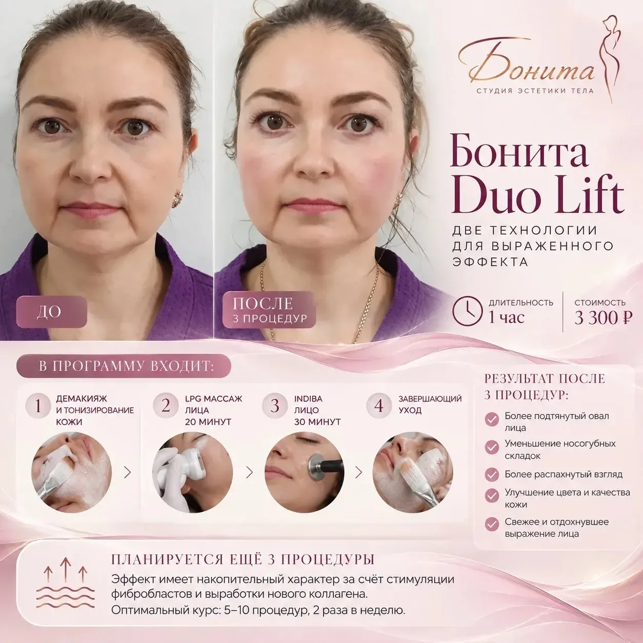 🤍 Результат программы Duo Lift