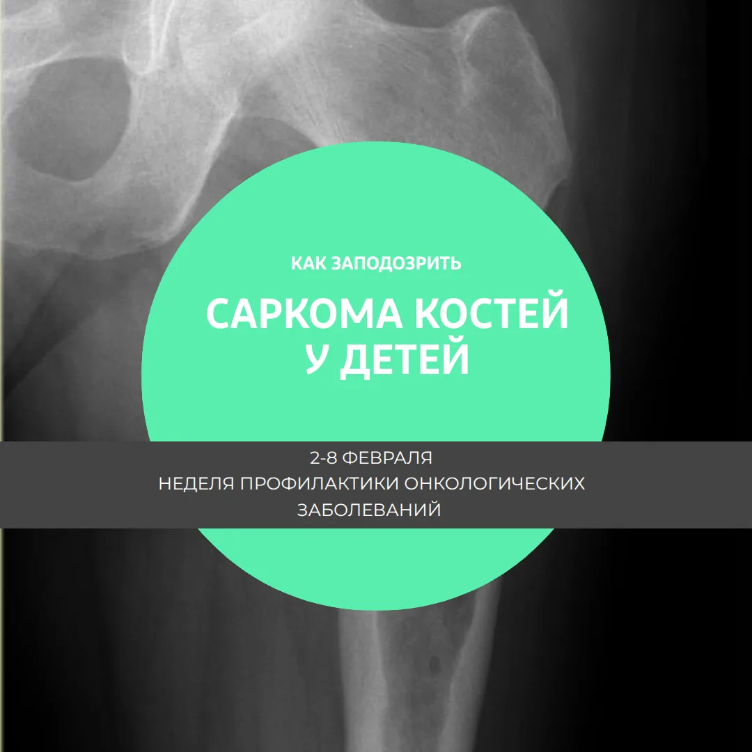 На что обратить внимание, чтобы не пропустить саркому кости у ребенка