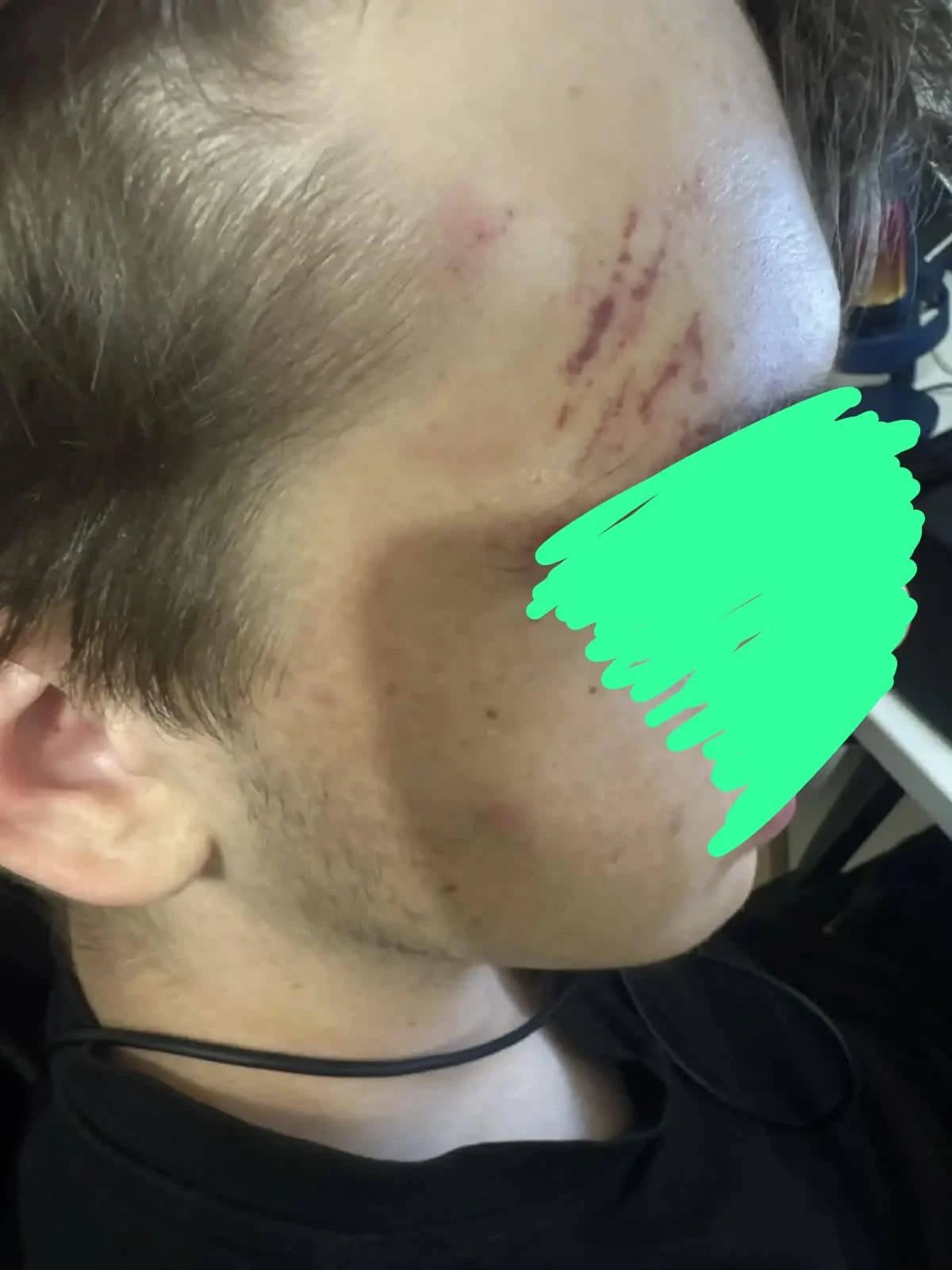 🚨 «Возвращение 90-х»: на улице Петра Сухова шестеро человек избили 16-летнего подростка