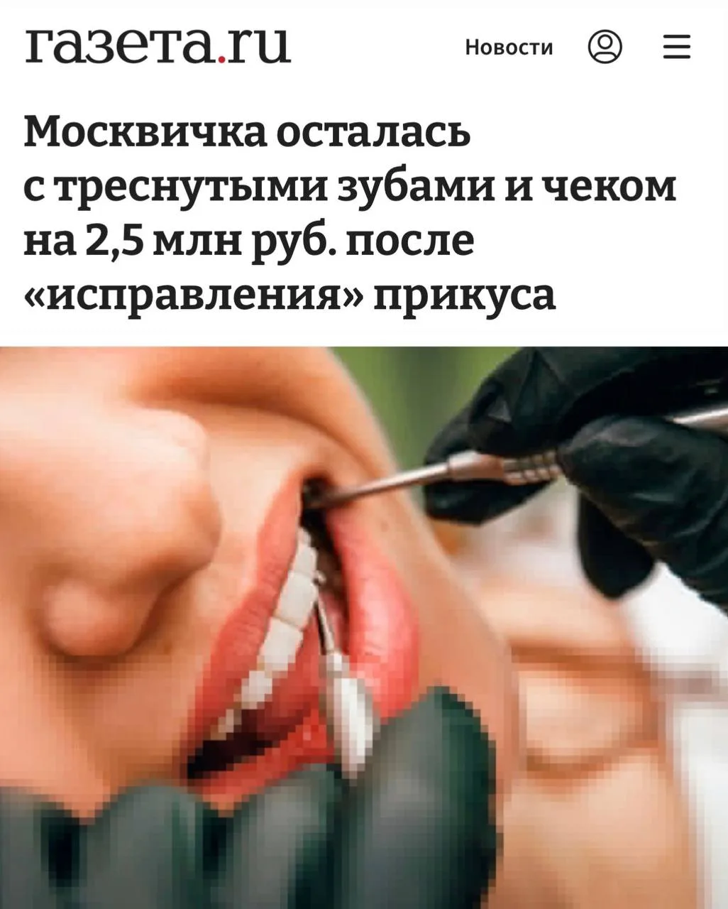 «Москвичка осталась с треснутыми зубами и чеком на 2,5 млн руб. после «исправления» при...