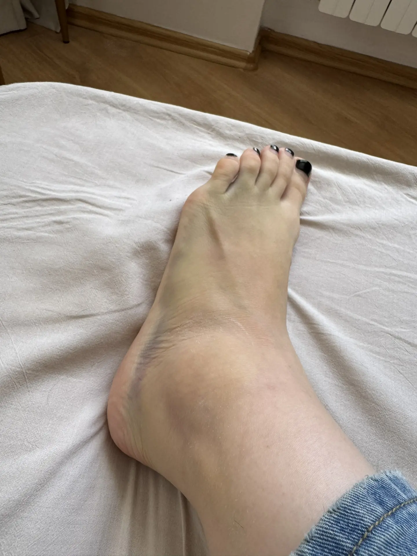 Моя левая нога неудачница😢🙈 Не успел синяк сойти со стопы, как я умудрилась ещё один ...