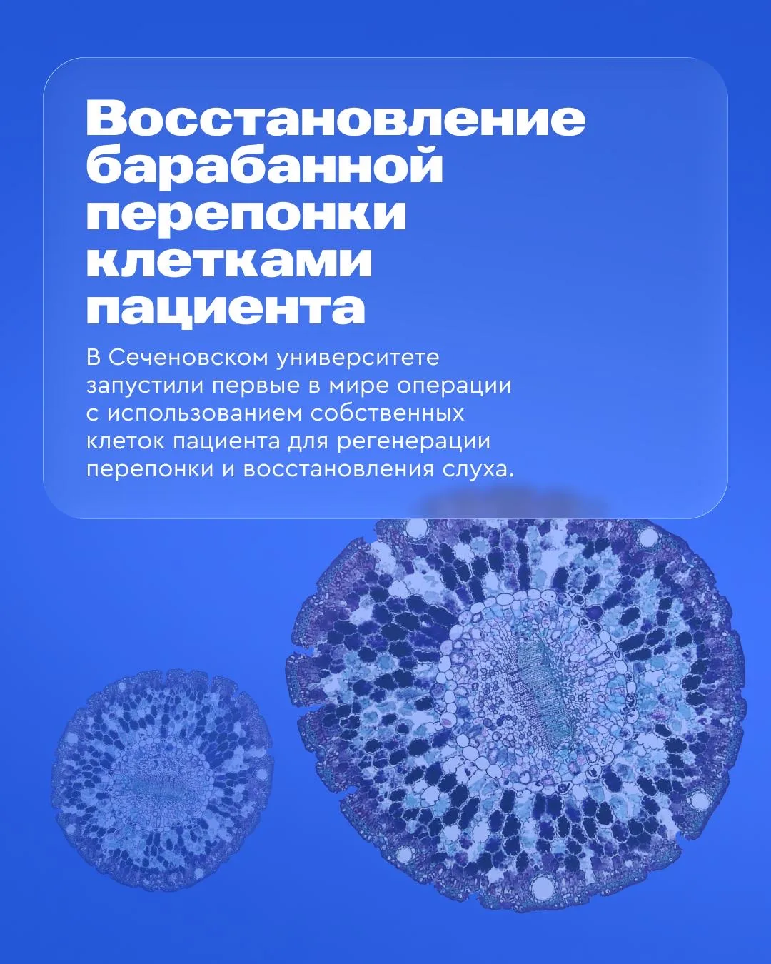 Это прорыв: новости из мира биомедицины ⚡  Газпромбанк как технологический лидер принимает активное 