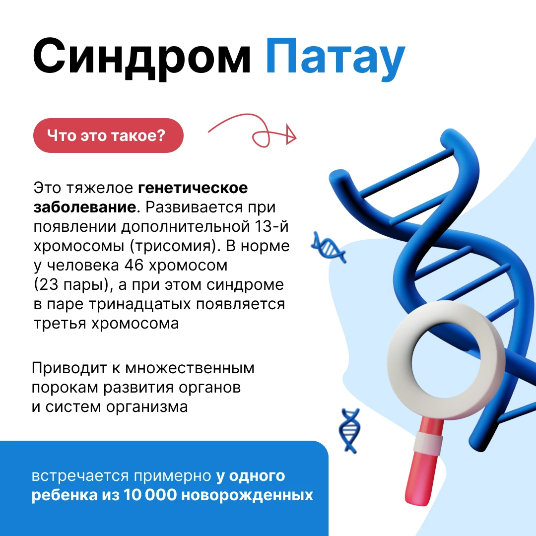🧠 Синдром Патау — это не просто редкая болезнь, а тяжелое генетическое расстройство.
