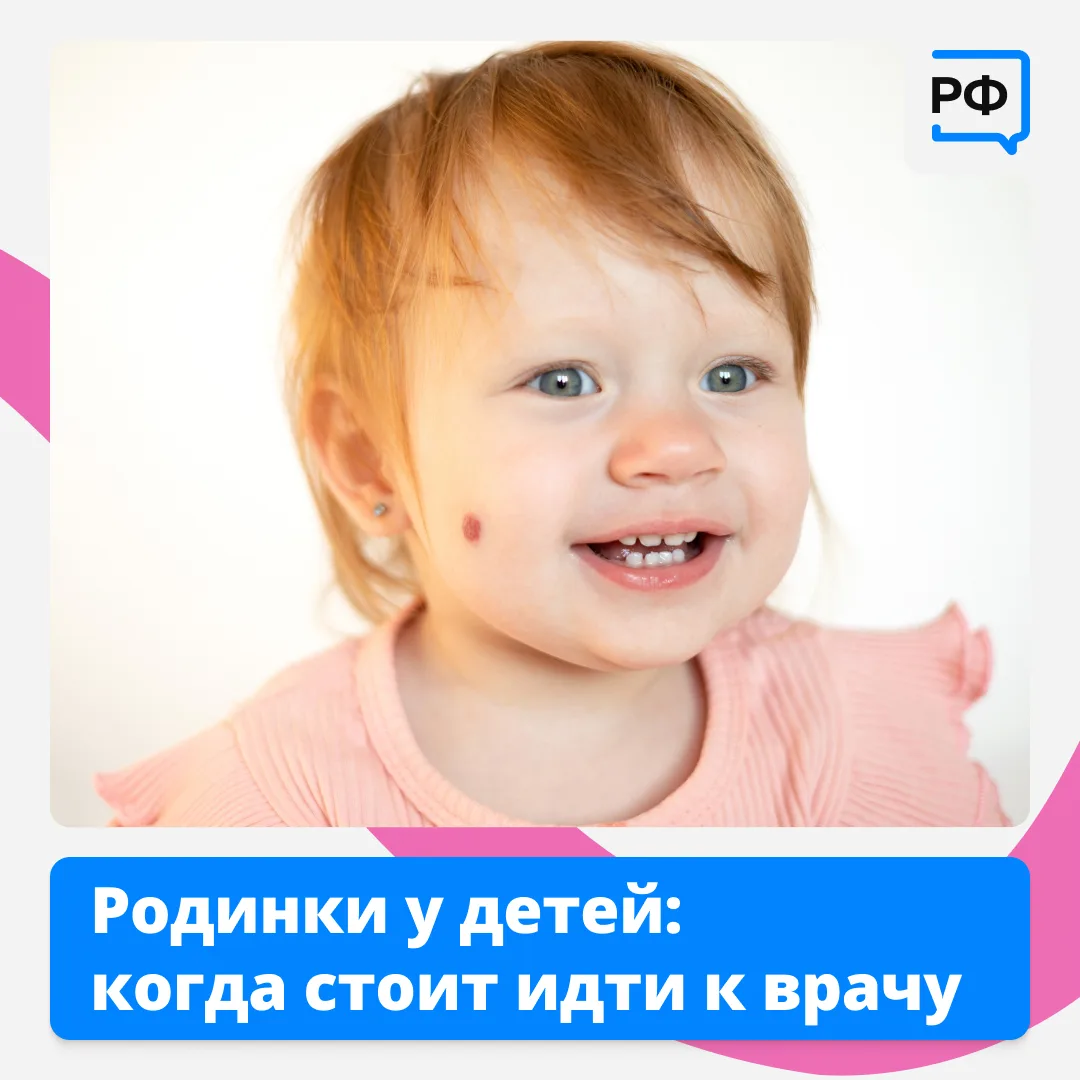 👩‍⚕️ Если у ребёнка родинки быстро растут или меняют цвет, это повод обратиться к врачу.