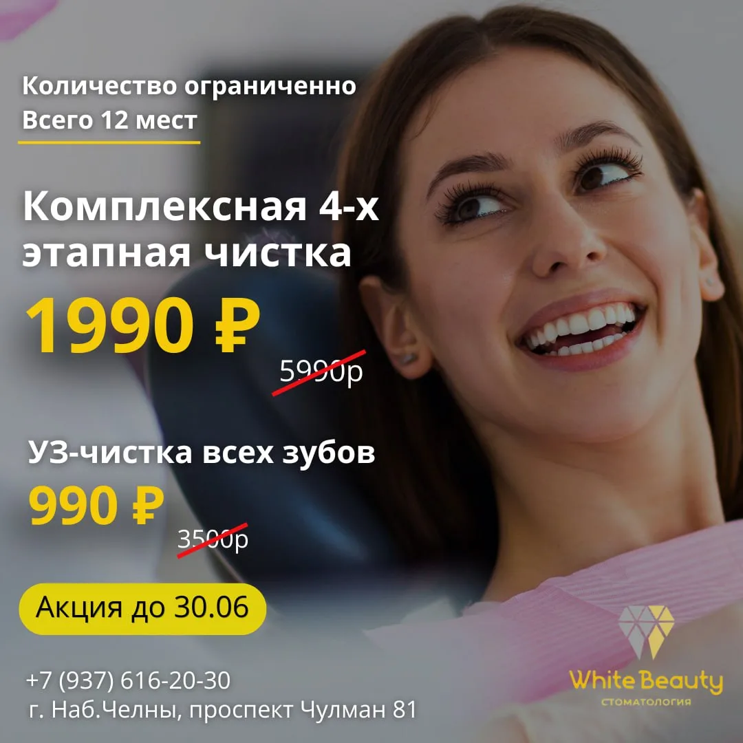 Зубной камень — скрытая угроза вашим зубам и здоровью в целом!