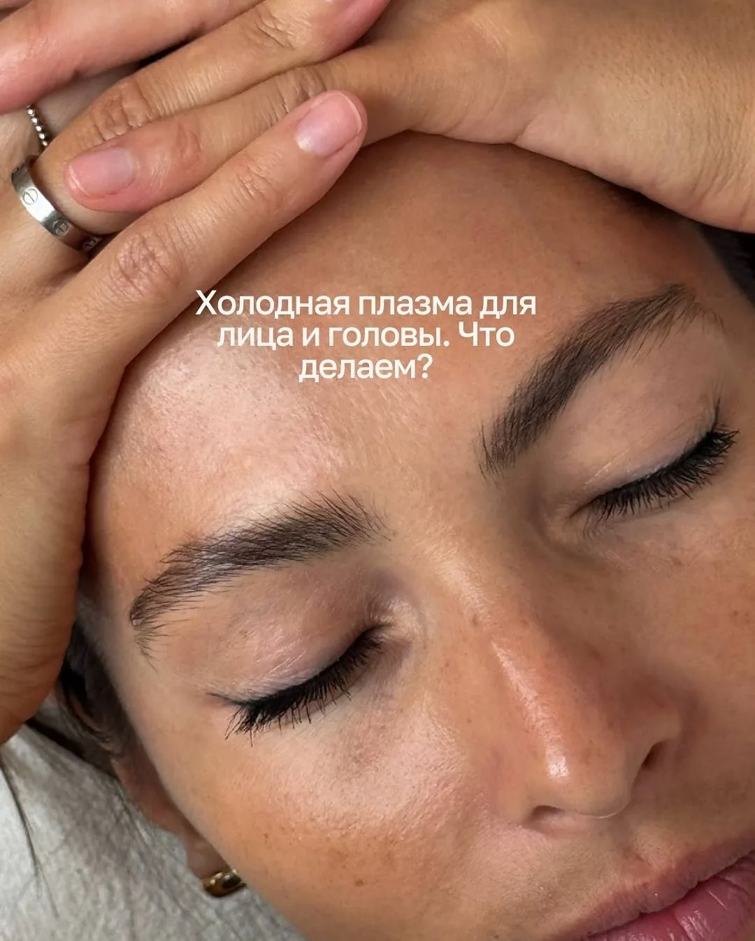 Холодная плазма для лица и кожи головы: что делаем и какие изменения видим? 👇