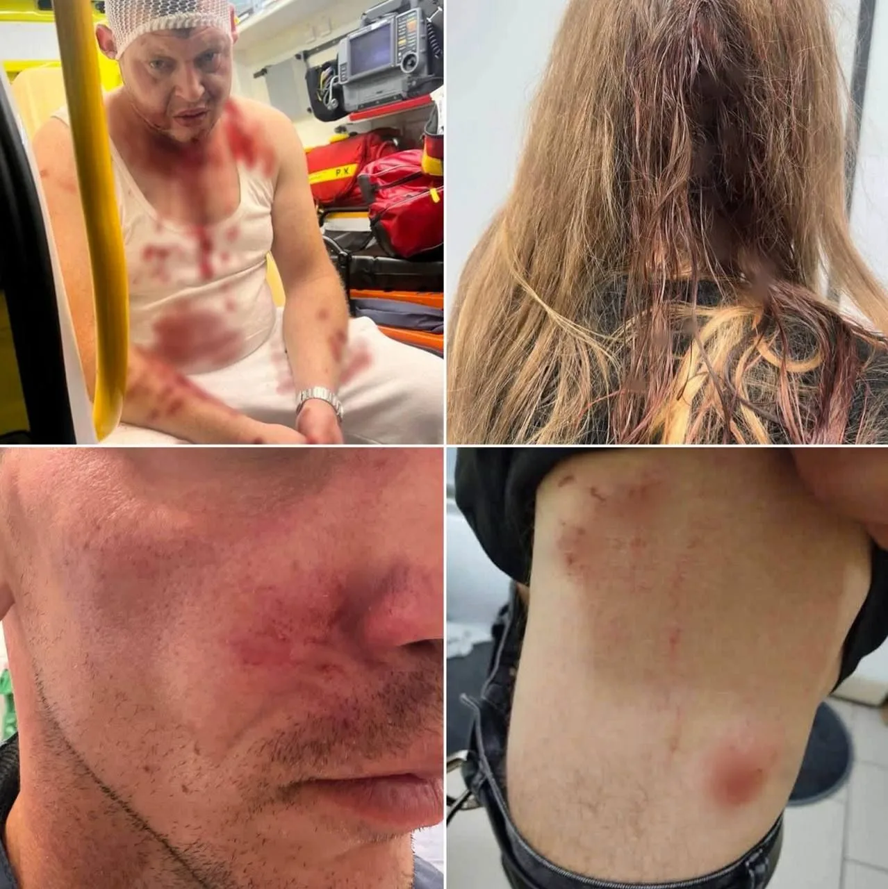 В Польше снова избили украинцев. На этот раз пострадали двое мужчин и женщина.