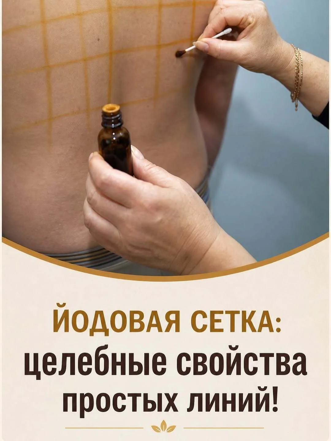 🌟 Йодовая сетка: целебные свойства простых линий!
