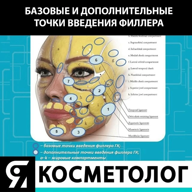 Сохраните полезную инфографику📲

Базовые и дополнительные точки ведения филлера на субдермальный и 