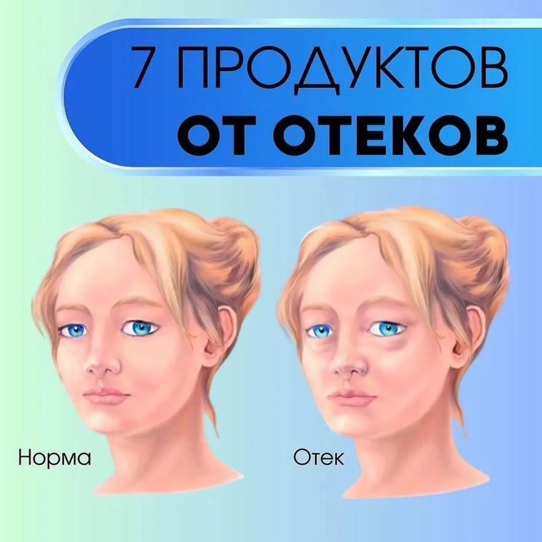 7 продуктов от отёков.