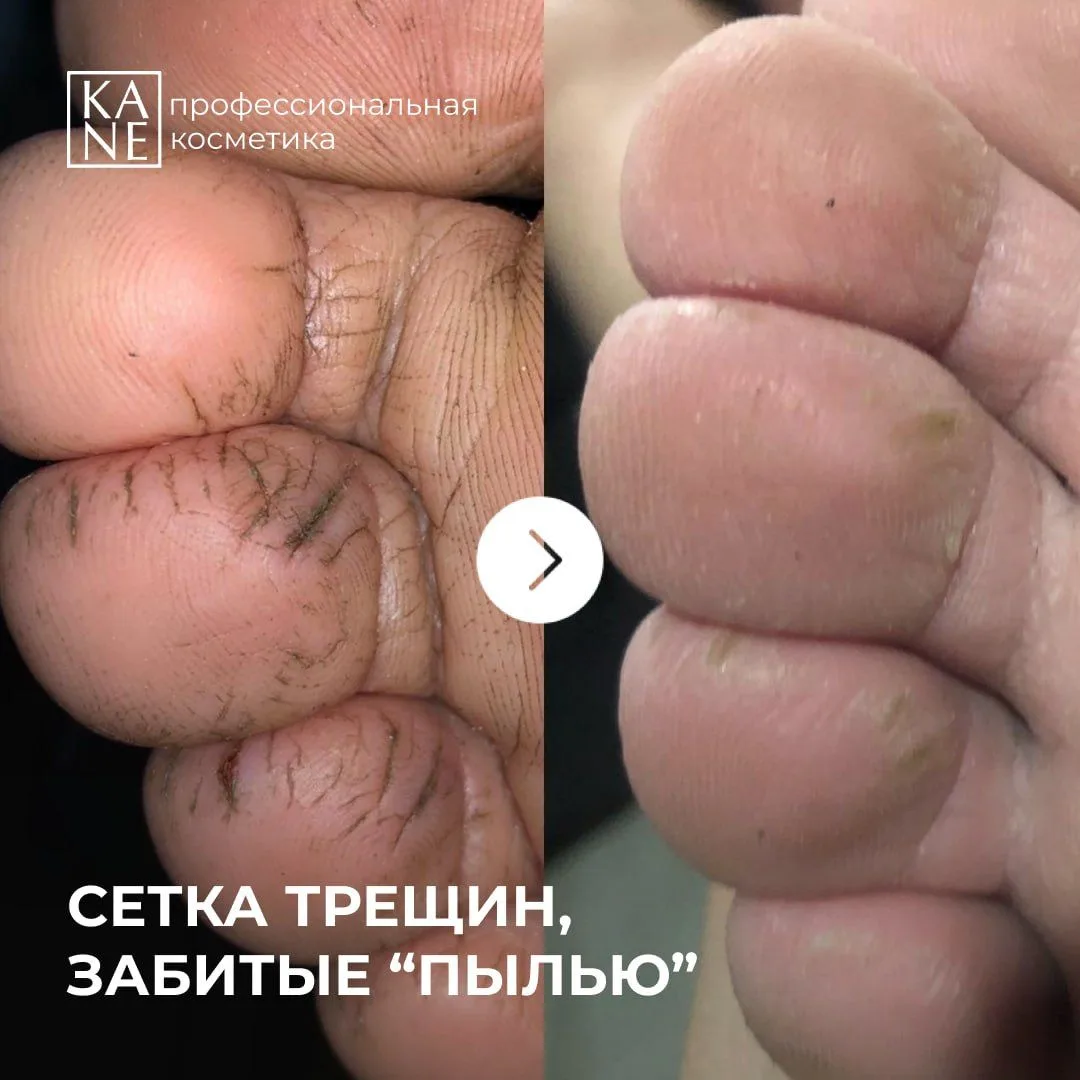 Что делать с сеткой трещин, забитых "пылью"? 🕸