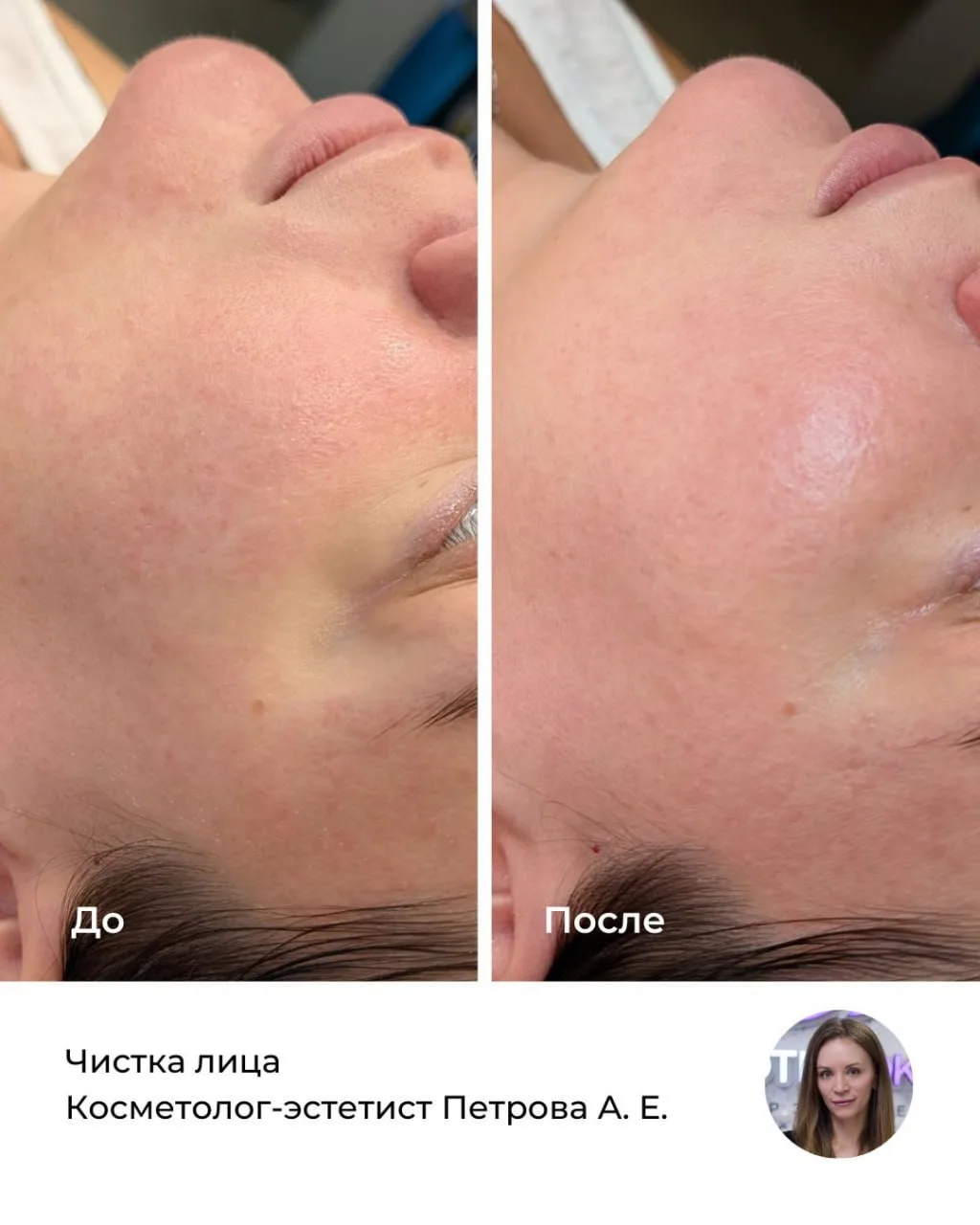 Иногда коже не нужно ничего сложного. Ей хочется чистоты, гладкости и ощущения свежести.