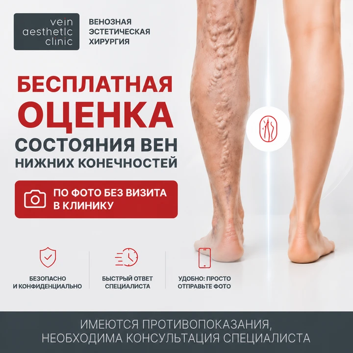 Боль, тяжесть и отеки в ногах — это не просто усталость.