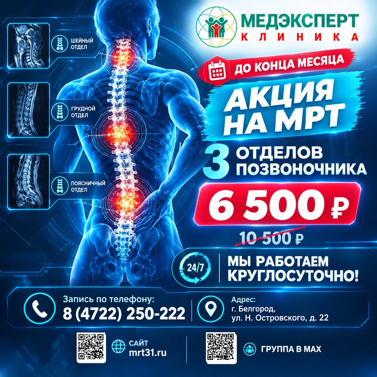МРТ 3-х отделов позвоночника за 6500 рублей до конца октября!