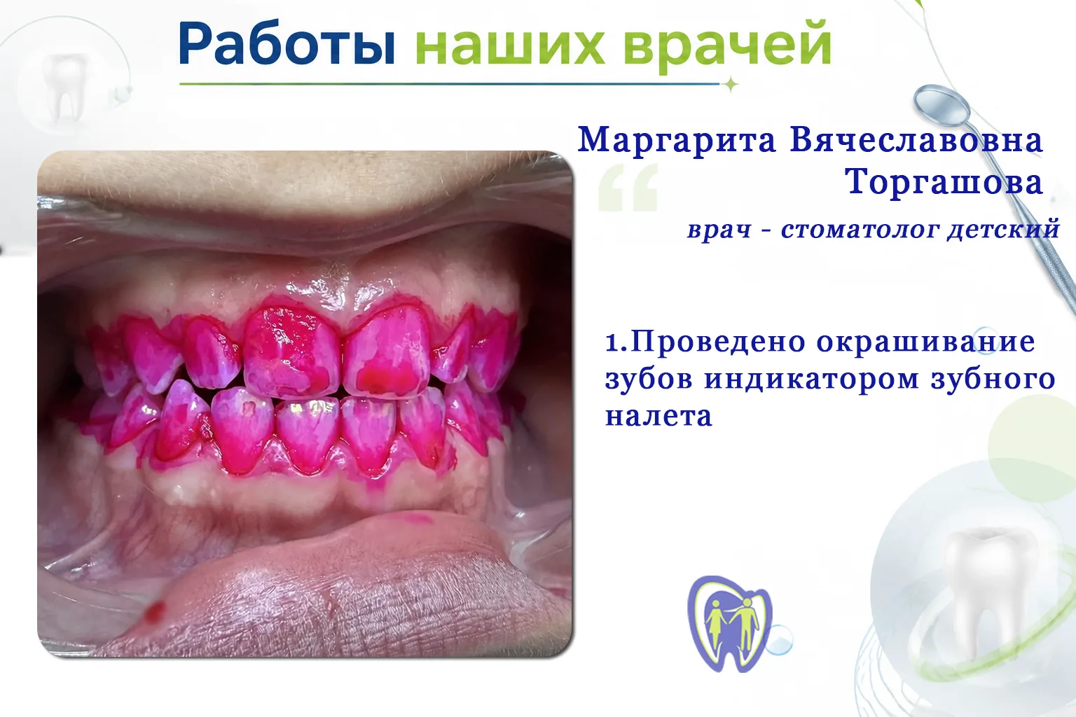 Профессиональная гигиена у детей, почему это важно