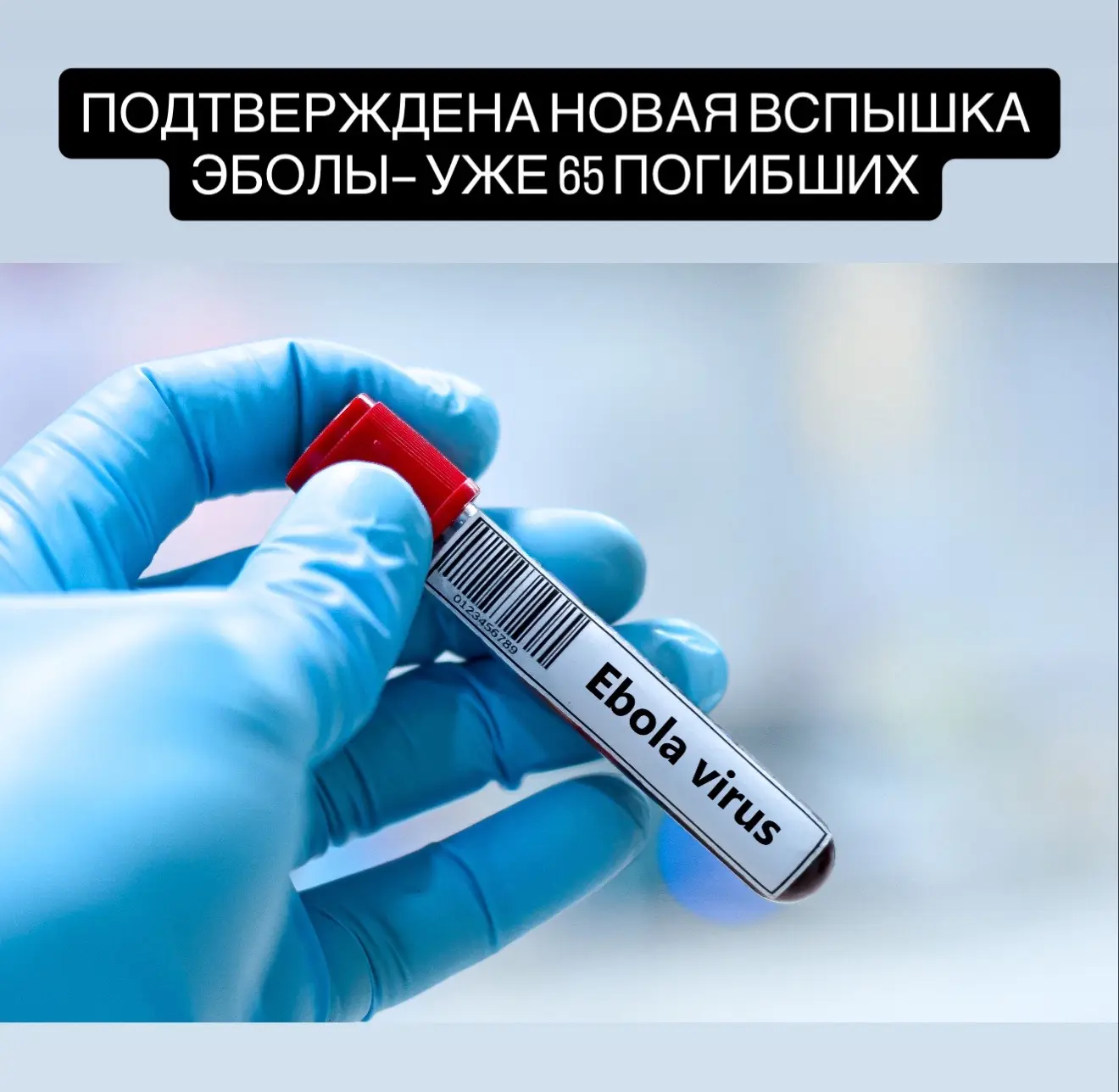 Подтверждена новая вспышка Эболы — уже 65 погибших и 246 заражённых на востоке Конго.  Очаги инфекц