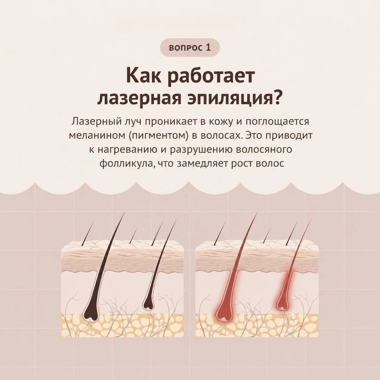 Ответили на самые популярные вопросы по ЛЭ👉🏻 листайте карточки карусели