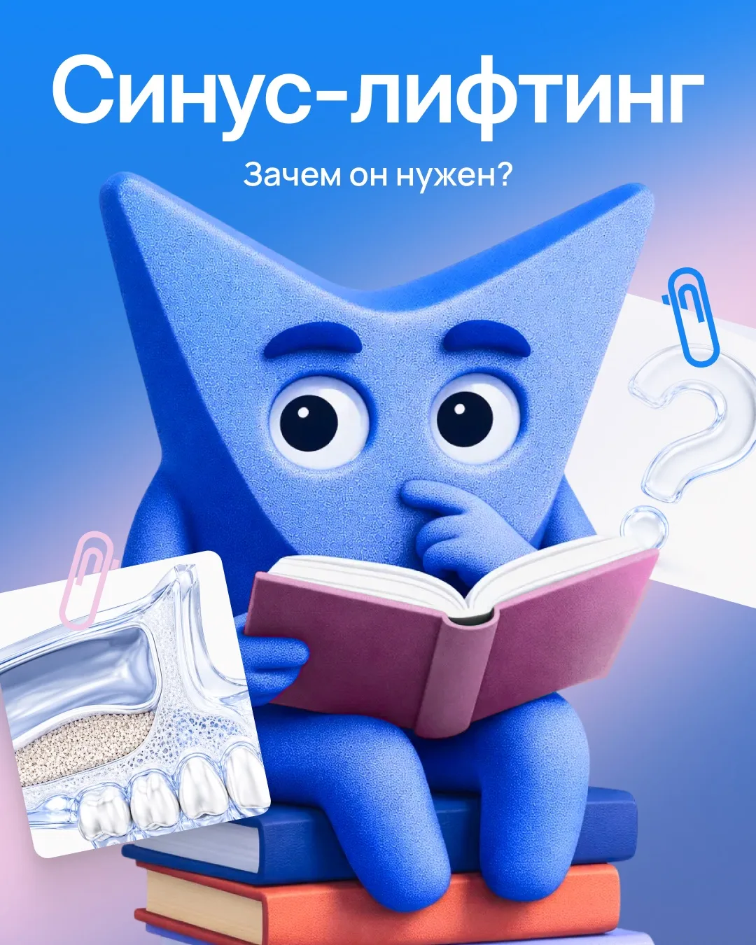 Зачем нужен синус-лифтинг перед имплантацией?🦷