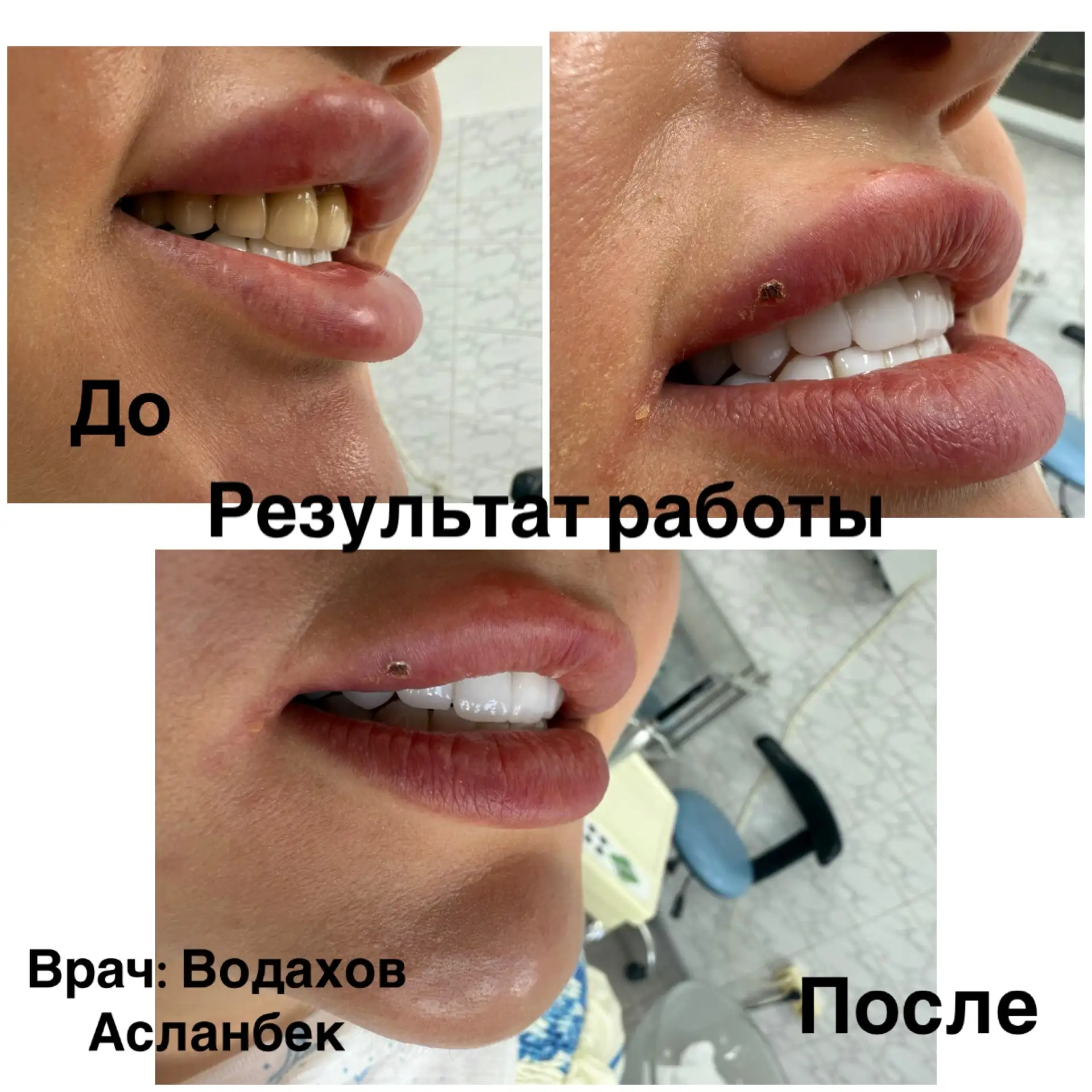 Иногда для идеальной улыбки нужно совсем немного✨⭐️