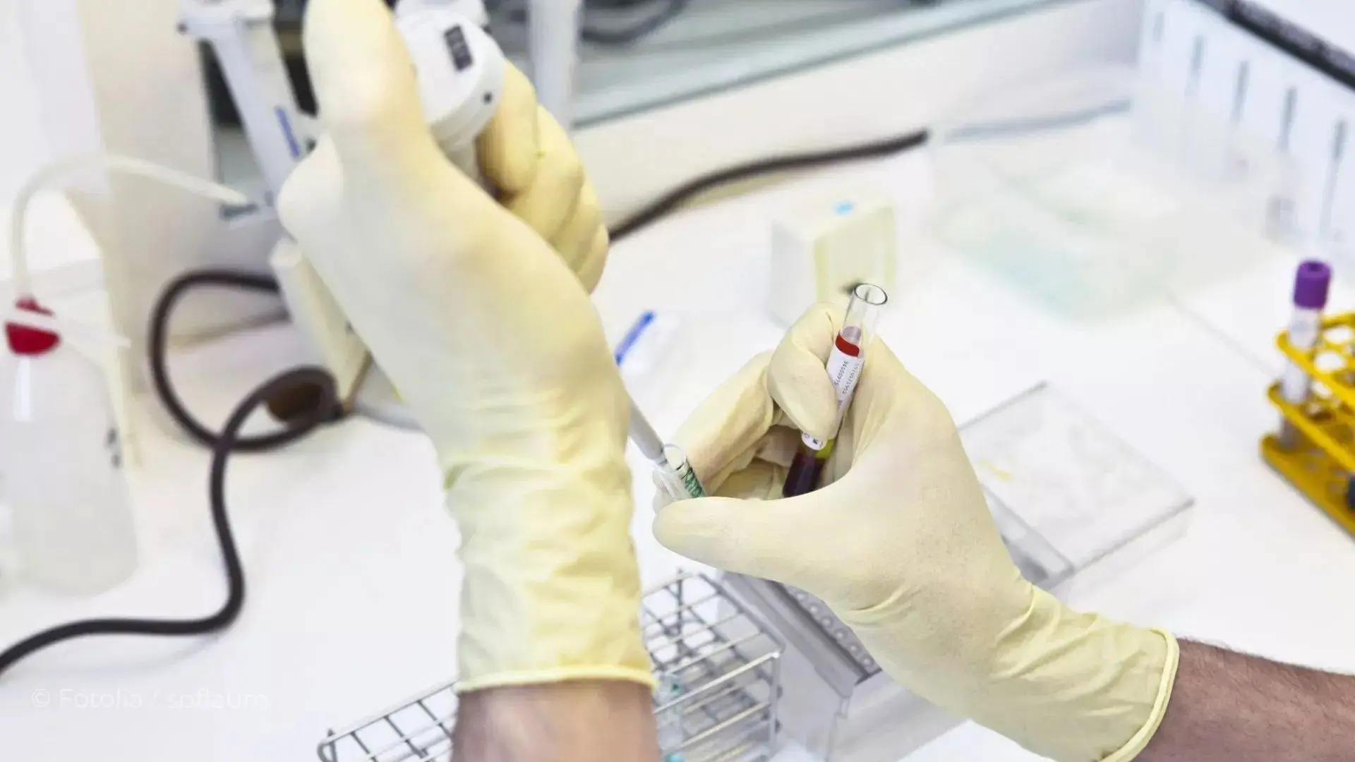 💉 В России определены показания для первой отечественной вакцины против меланомы

Согласно информац