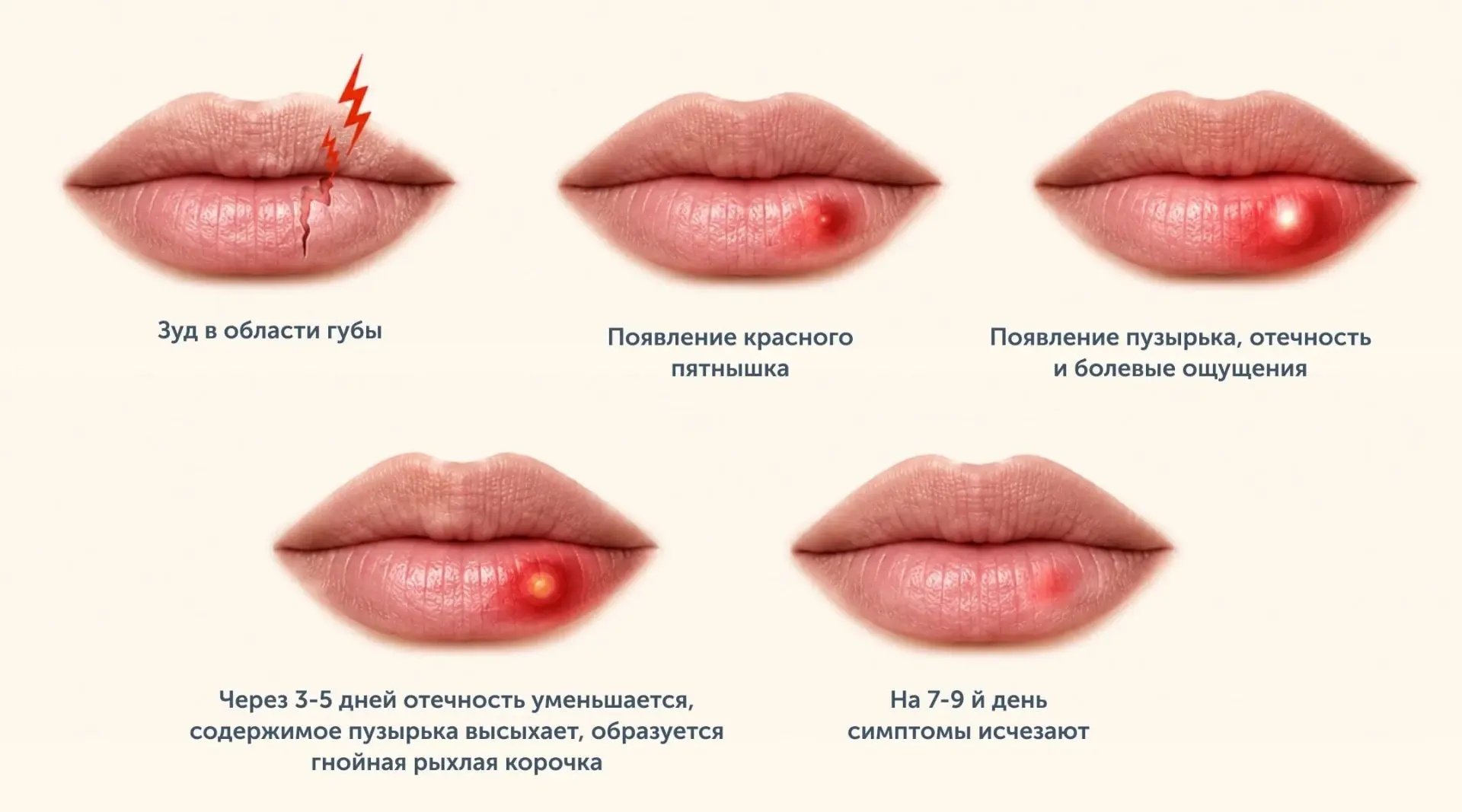 Изображение 1 к публикации «Моё Здоровье❤️‍🩹»
