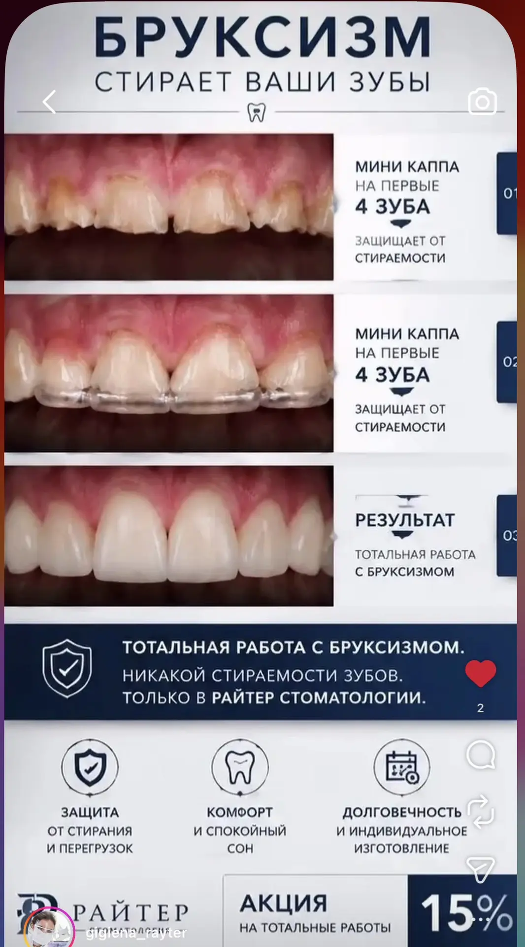 Скидка 15% на тотальные работы в Райтер стоматологии на Верхних полях у грамотных враче...