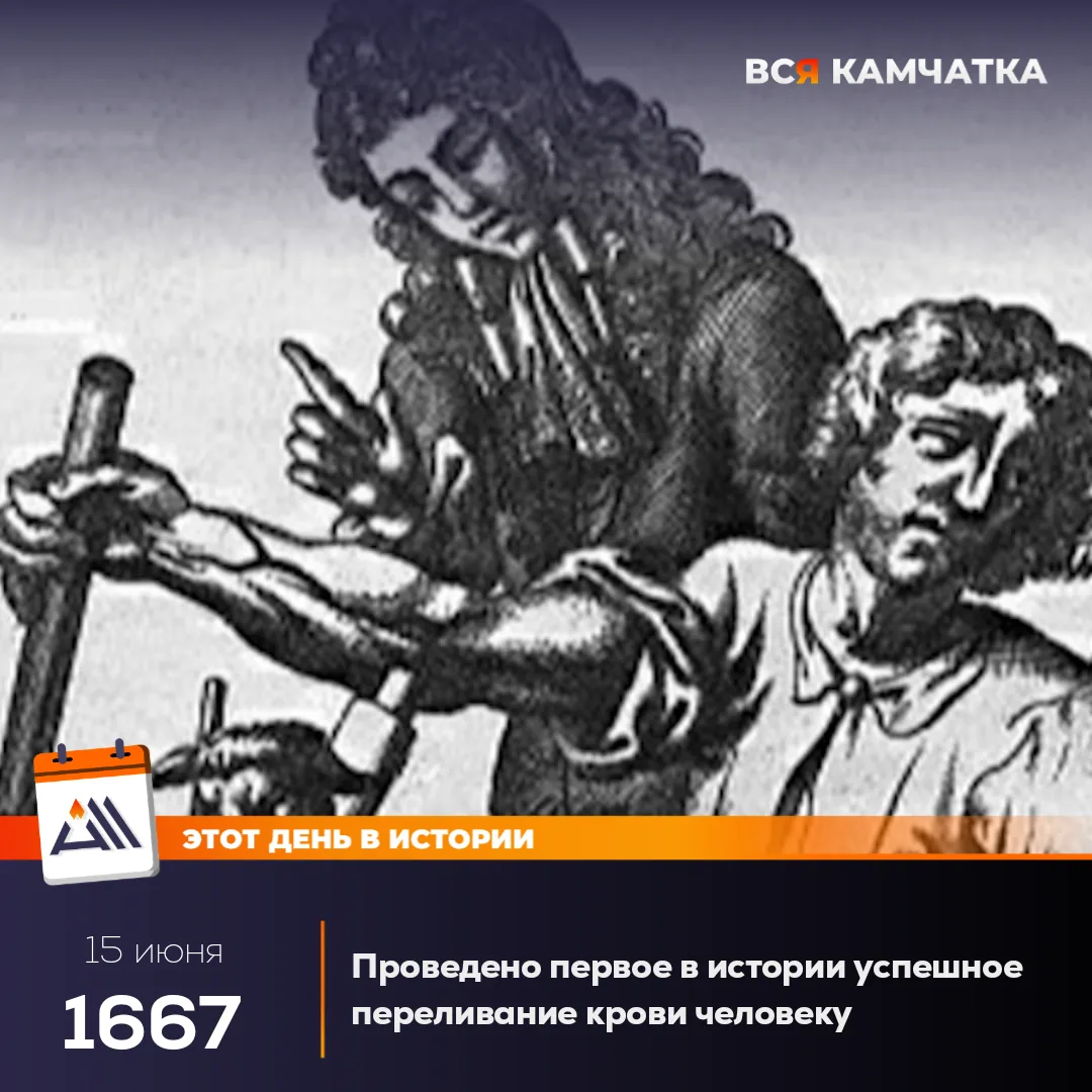 15 июня 1667 года Жан-Батист Дени перелил 16-летнему юноше с лихорадкой 250 мл крови ягненка. Пациен