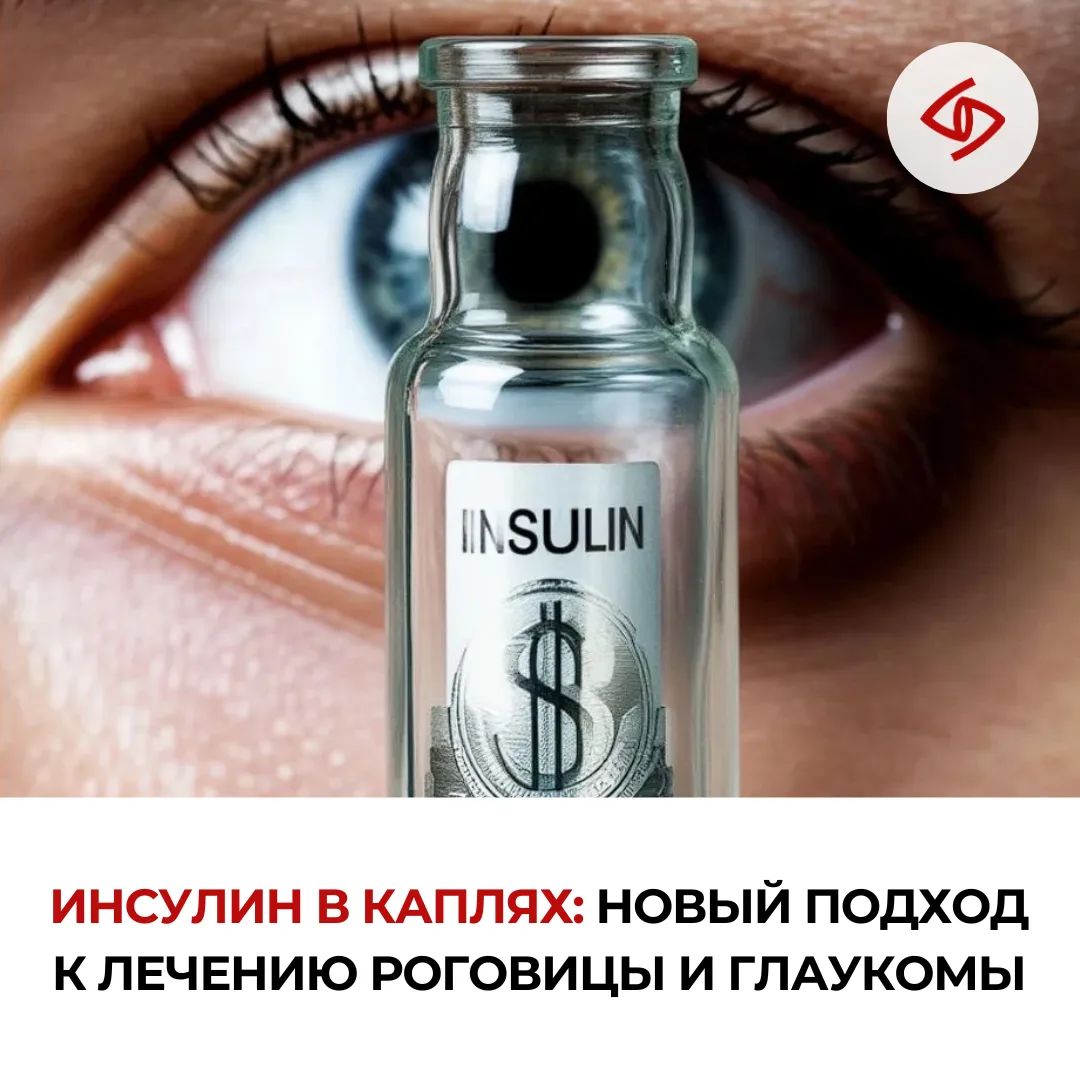 💧👁️ Инсулин для глаз: новое слово в офтальмологии?