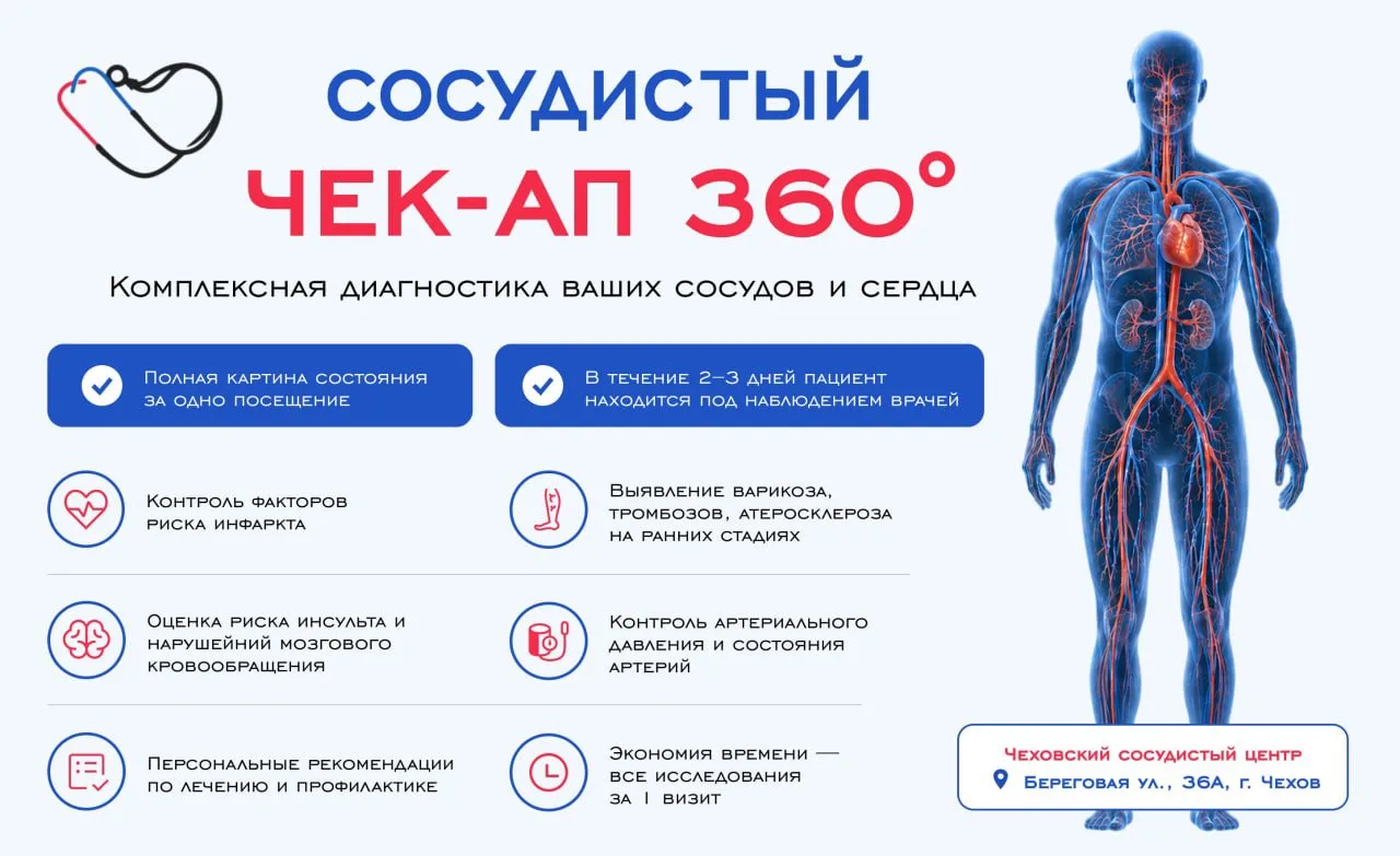 🔍 Сосудистый чек-ап 360° в Чеховском сосудистом центре.