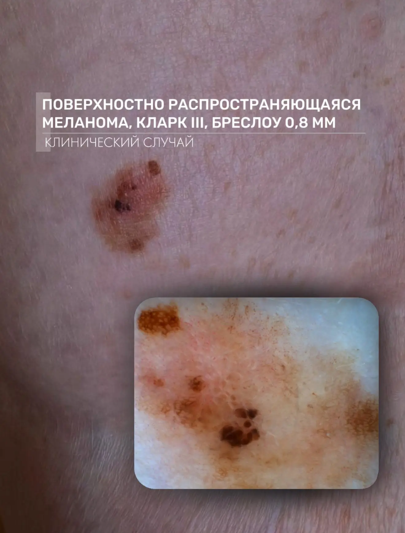 Клинический случай