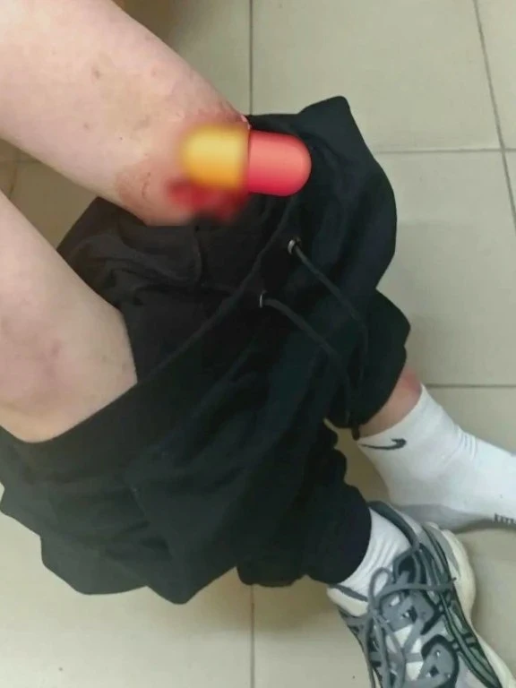 Ребёнок провалился на площадке в Сарафоново