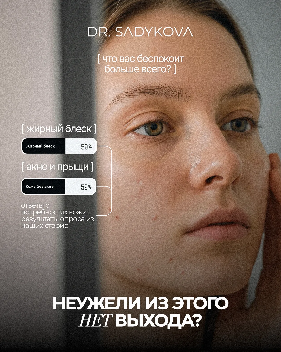 Жирный блеск. Забитые поры. Воспаления. Неужели из этого нет выхода? 💔