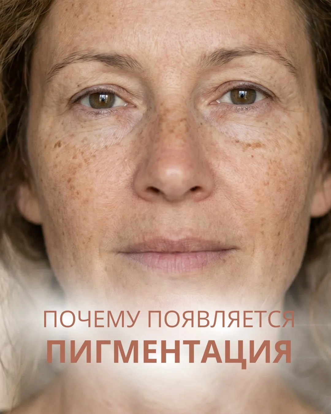 Если вы хотите не только разобраться в вопросе, но и избавиться от пигментных пятен нав...