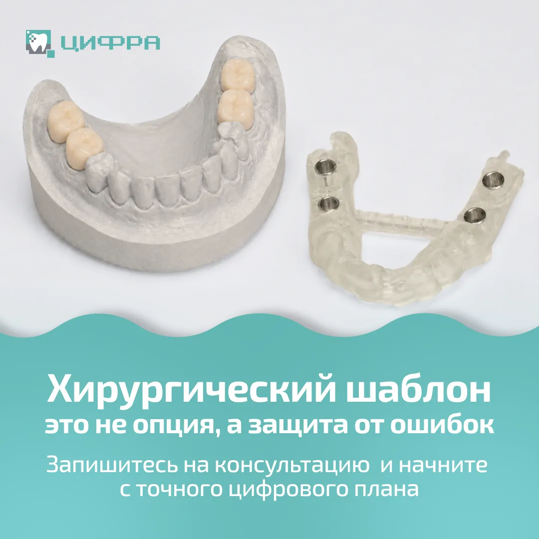 Имплантация: лотерея или точный расчет?