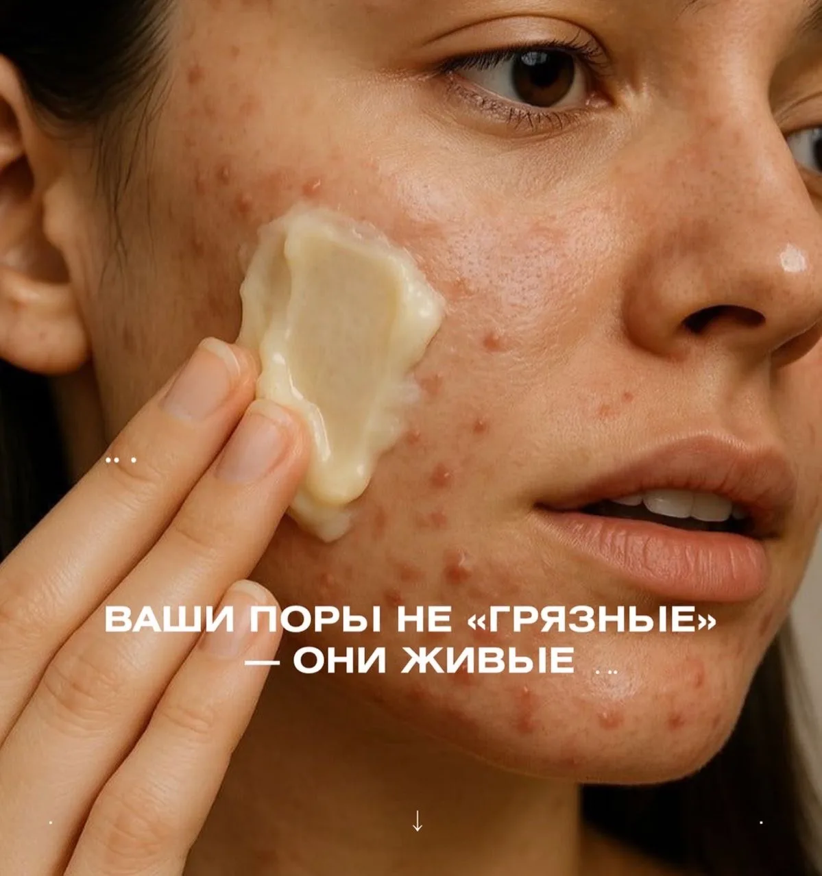 Ваши поры не грязные — они живые

Многие уверены, что черные точки — это «грязь» в порах. На самом д
