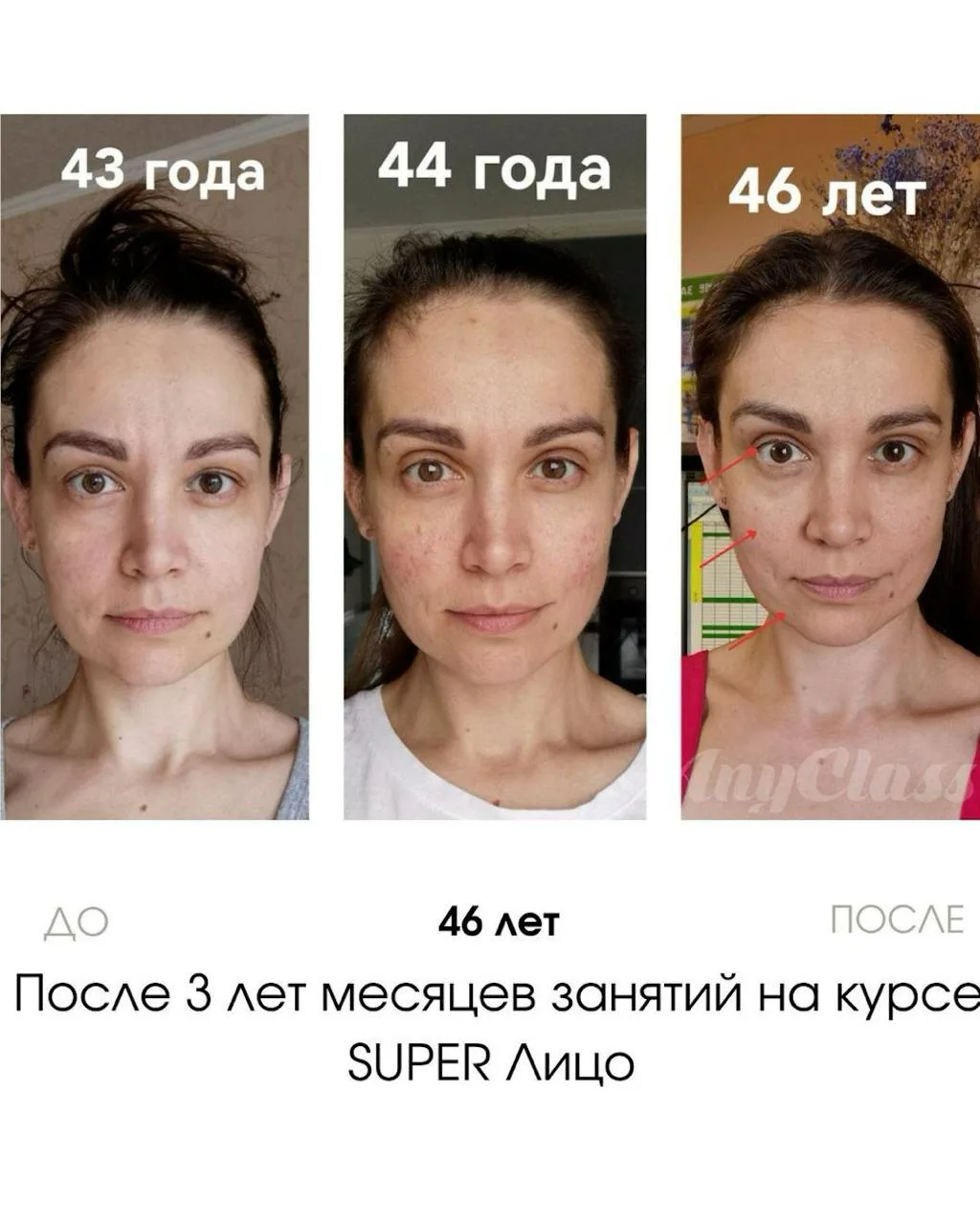 Сейчас все гонятся за острыми скулами и утончённым лицом, и многим кажется, что единственный путь - 