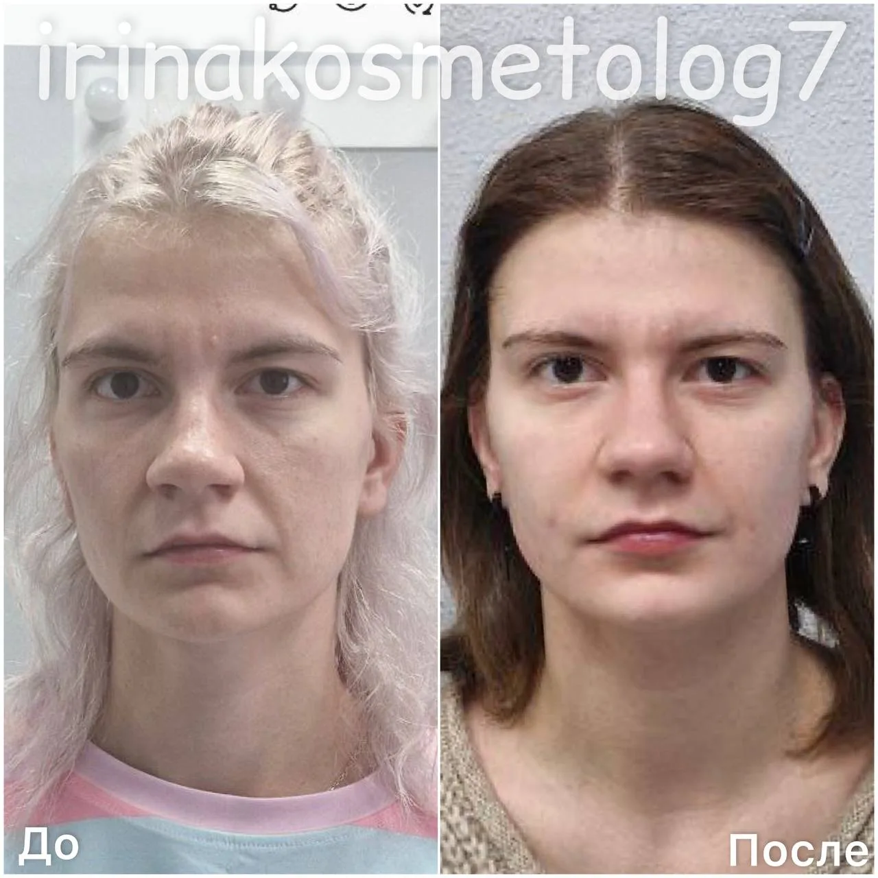 Не могла не поделиться таким результатом 👍