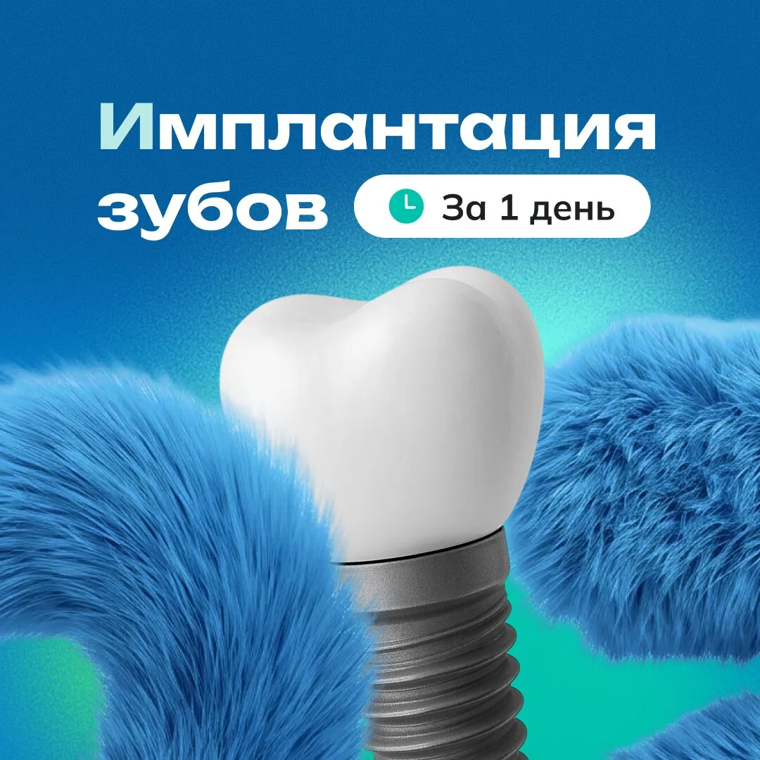 Бесшовная имплантация зуба с коронкой за 1 день в Казани