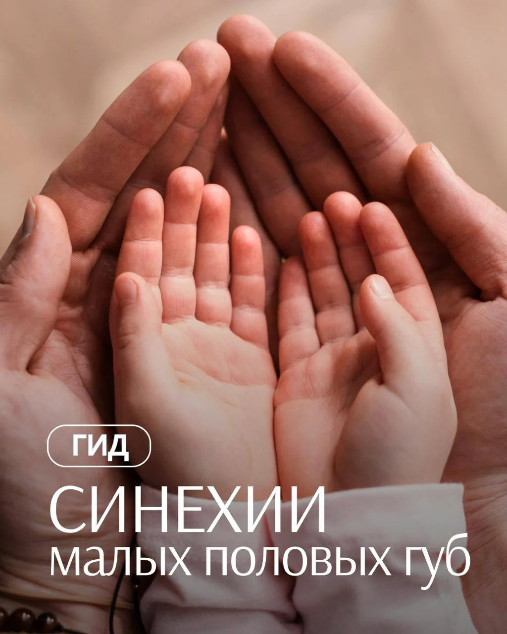 🌸 Гид по синехиям малых половых губ у девочек 
Я вам уже говорила, что сейчас синехий стало много. 