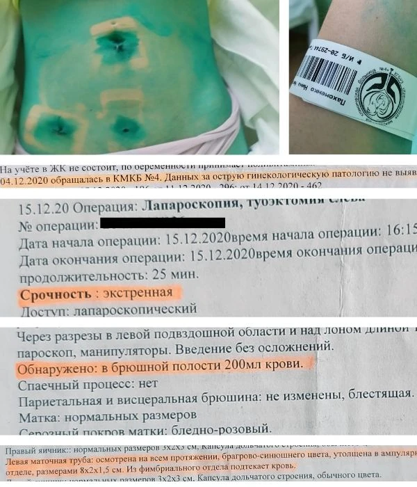 Личная история
 
4 декабря 2020 года я обратилась в больницу с подозрением на внематочную беременнос