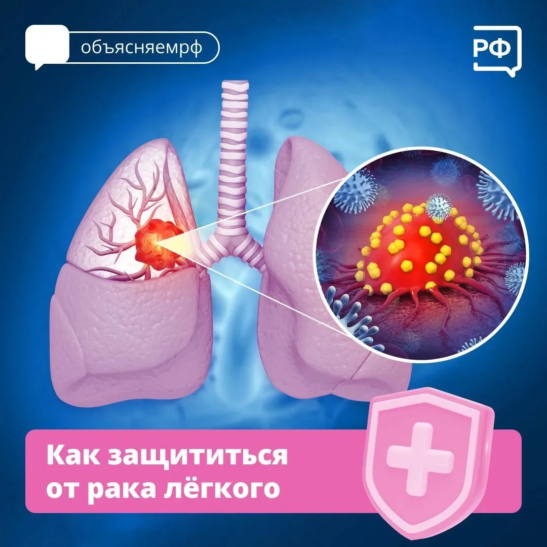 ❗️ Курение — причина около 90% смертей от рака лёгкого у мужчин и почти 80% — у женщин....