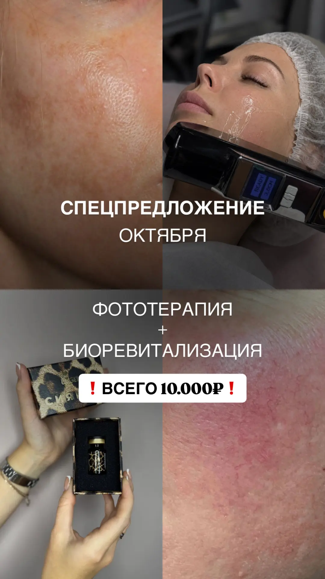 Фото
