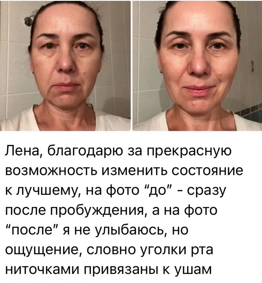 ЭФФЕКТ ПОСЛЕ БАНОК ⬆️