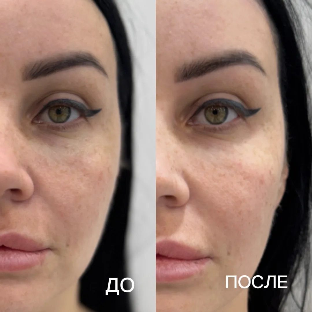 5 признаков, что коже пора помочь после лета