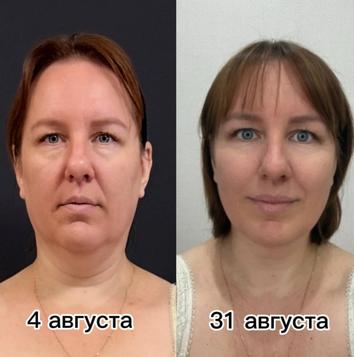 Иногда результат лучше любых слов. Просто посмотрите на эти две фотографии.