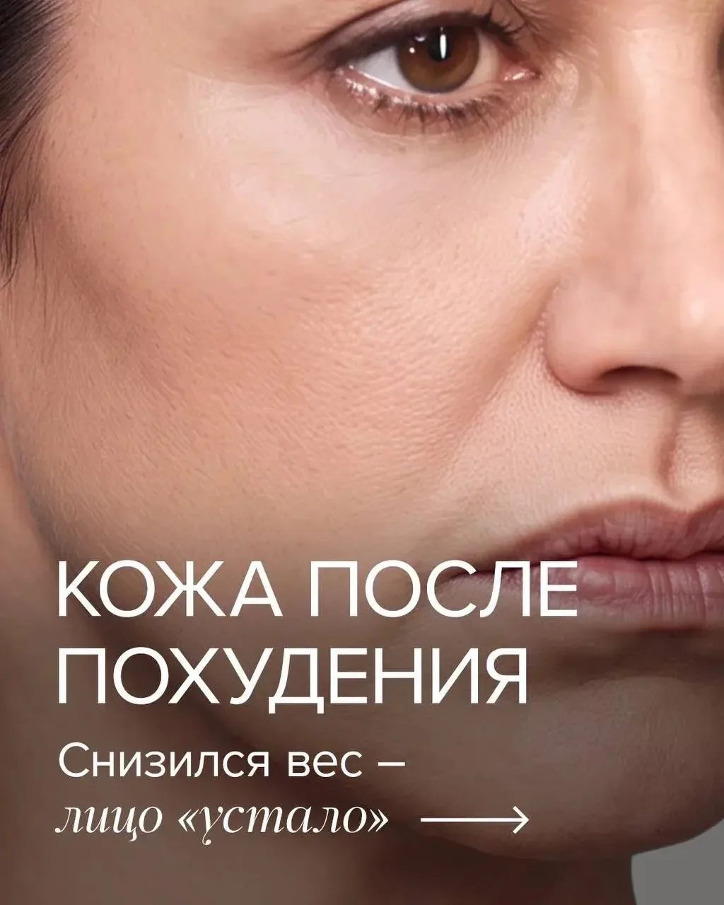 Я похудела — а лицо постарело 🫩